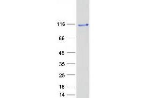 Validation with Western Blot (IGFN1 Protein (Myc-DYKDDDDK Tag))