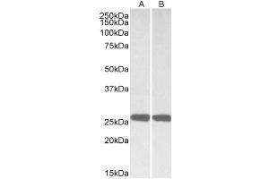 Western Blotting (WB) image for anti-Ubiquitin Carboxyl-terminal Esterase L1 (Ubiquitin Thiolesterase) (UCHL1) (AA 58-68) antibody (ABIN5882512) (UCHL1 anticorps  (AA 58-68))