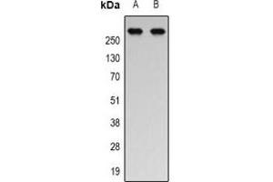 Western blot analysis of p300 (AcK1558/K1560) expression in Jurkat (A), HEK293T (B) whole cell lysates. (p300 anticorps  (acLys1558, acLys1560))