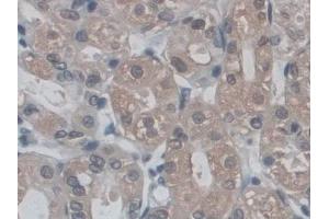 IHC-P analysis of Human Stomach Tissue, with DAB staining. (POMT1 anticorps  (AA 318-513))