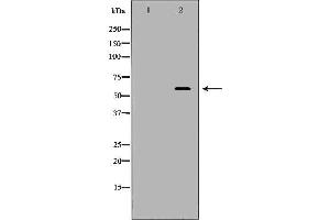 Western blot analysis of Hela whole cell lysates, using KPNA1 Antibody. (KPNA1 anticorps  (N-Term))