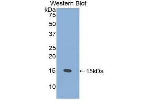 Western blot analysis of the recombinant protein. (PSCA anticorps  (AA 22-95))