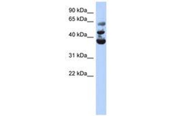 NSUN3 anticorps  (AA 143-192)