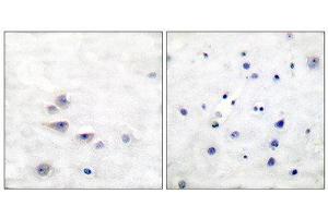 Immunohistochemistry (IHC) image for anti-SHC (Src Homology 2 Domain Containing) Transforming Protein 1 (SHC1) (pTyr427) antibody (ABIN1847216) (SHC1 anticorps  (pTyr427))