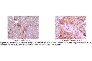 Image no. 2 for anti-Mitogen-Activated Protein Kinase 10 (MAPK10) antibody (ABIN207628) (MAPK10 anticorps)