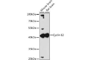 Western blot analysis of extracts of various cell lines, using Cyclin E2 antibody (ABIN1679046, ABIN3018761, ABIN3018762 and ABIN6220571) at 1:3000 dilution. (Cyclin E2 anticorps  (C-Term))