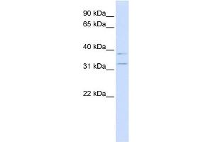 KCNRG antibody used at 1 ug/ml to detect target protein. (KCNRG anticorps  (N-Term))