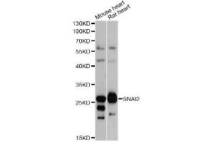 Western blot analysis of extracts of various cell lines, using SNAI2 antibody (ABIN5970416) at 1/1000 dilution. (SLUG anticorps)