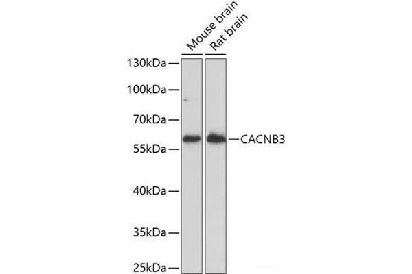 CACNB3 anticorps