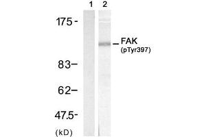 Western blot analysis of extract from 3T3 cell, using FAK (phospho-Tyr397) antibody (E011215, Lane 1 and 2). (FAK anticorps  (pTyr397))