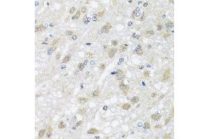 Immunohistochemistry of paraffin-embedded rat brain using HARS2 antibody at dilution of 1:100 (x40 lens). (HARS2 anticorps)
