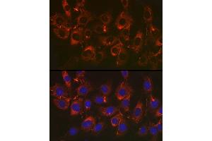 Immunofluorescence analysis of NIH/3T3 cells using Fibronectin Rabbit mAb (ABIN6133698, ABIN6135676, ABIN6135677 and ABIN7101415) at dilution of 1:50 (40x lens). (Fibronectin 1 anticorps)