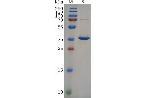Human NEFL(89-400) Protein, His Tag on SDS-PAGE under reducing condition. (NEFL Protein (AA 89-400) (His tag))