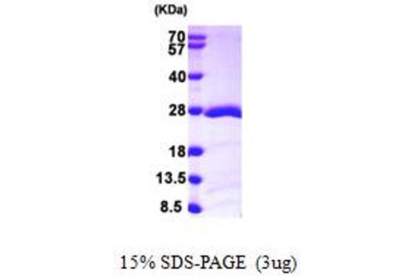 RAP1B Protein (AA 1-181) (His tag)