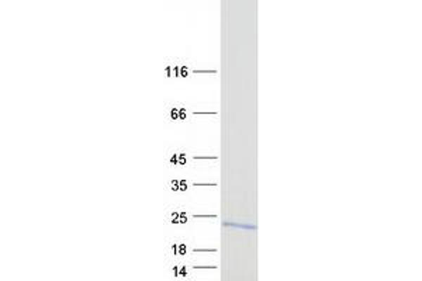 TIMM8B Protein (Transcript Variant 1) (Myc-DYKDDDDK Tag)