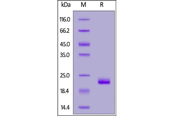 ZNRF3 Protein (AA 56-219) (His tag)