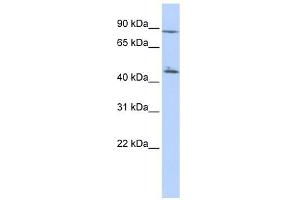 C6ORF199 antibody used at 1 ug/ml to detect target protein. (AKD1 anticorps  (N-Term))