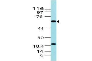 Image no. 1 for anti-T-Complex 1 (TCP1) (AA 1-202) antibody (ABIN5027416) (TCP1 alpha/CCTA anticorps  (AA 1-202))