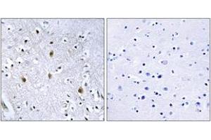 Immunohistochemistry analysis of paraffin-embedded human brain tissue, using IRS-1 (Ab-639) Antibody. (IRS1 anticorps  (AA 605-654))