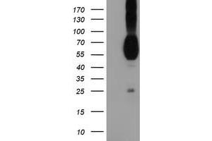 HEK293T cells were transfected with the pCMV6-ENTRY control (Left lane) or pCMV6-ENTRY PVRL1 (Right lane) cDNA for 48 hrs and lysed. (PVRL1 anticorps)