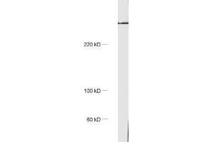 dilution: 1 : 1000, sample: rat brain homogenate (Golgin B1 (GOLGB1) anticorps)