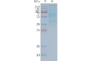 Human -Nanodisc, Flag Tag on SDS-PAGE (GPR20 Protéine)