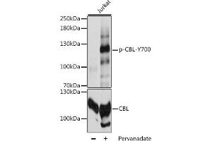 Western blot analysis of extracts of Jurkat cells, using Phospho-CBL-Y700 antibody (ABIN6135196, ABIN6136034, ABIN6136035 and ABIN6225680) at 1:2000 dilution or CBL antibody (ABIN6131302, ABIN6138002, ABIN6138004 and ABIN6213970). (CBL anticorps  (pTyr700))