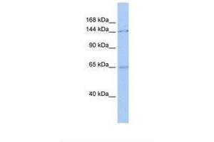 Image no. 1 for anti-Structural Maintenance of Chromosomes 1A (SMC1A) (C-Term) antibody (ABIN6737852) (SMC1A anticorps  (C-Term))