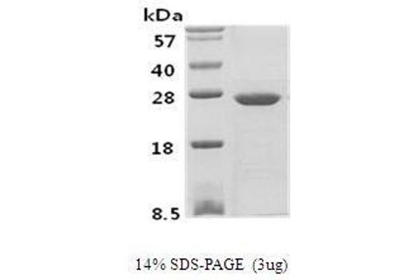 PSPH Protein (AA 1-382) (His tag)