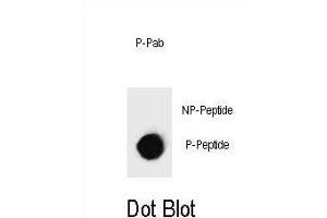 Dot blot analysis of Phospho-IKKB- Antibody Phospho-specific Pab (ABIN1539772 and ABIN2839876) on nitrocellulose membrane. (IKBKB anticorps  (pSer697))