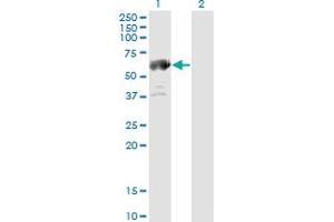 Western Blotting (WB) image for anti-Aldehyde Dehydrogenase 4 Family, Member A1 (ALDH4A1) (AA 1-564) antibody (ABIN599053) (ALDH4A1 anticorps  (AA 1-564))