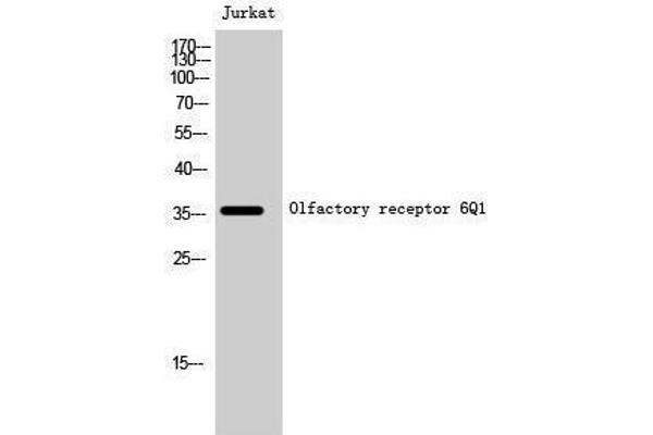 OR6Q1 anticorps  (Internal Region)