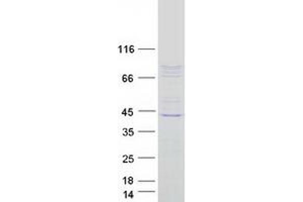 CSRP2BP Protein (Transcript Variant 2) (Myc-DYKDDDDK Tag)