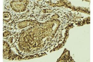 ABIN6269152 at 1/100 staining Mouse colon tissue by IHC-P. (ATF2 anticorps  (N-Term))