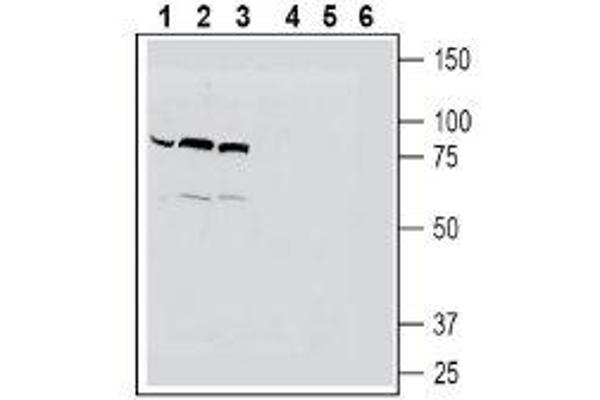 SLC22A4 anticorps  (C-Term, Intracellular)