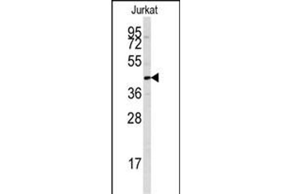 PTPN7 anticorps  (AA 22-51)