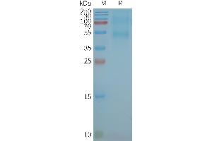 Human C-Nanodisc, Flag Tag on SDS-PAGE (CXCR5 Protéine)