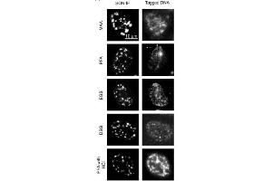 Images comparing the SON (a marker for nuclear speckles) immunofluorescence (IF) images (left panels) in different fixation conditions (MAA, methanol/acetic acid, 1% PFA; EGS, ethylene glycol bis(succinimidyl succinate); DSG, disuccinimidyl glutarate, 1% PFA followed by 0. (SON anticorps  (N-Term))