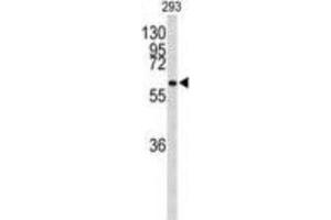 Western Blotting (WB) image for anti-Parafibromin (CDC73) antibody (ABIN3004068) (HRPT2 anticorps)