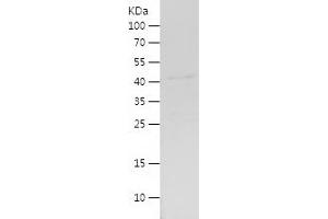 Western Blotting (WB) image for Myeloid/lymphoid Or Mixed-Lineage Leukemia 5 (Trithorax Homolog) (MLL5) (AA 1-350) protein (His tag) (ABIN7124042) (MLL5/KMT2E Protein (AA 1-350) (His tag))