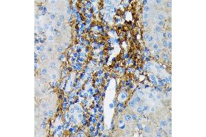 Immunohistochemistry of paraffin-embedded human liver using Collagen VI/COL6 Rabbit mAb (ABIN7266462) at dilution of 1:100 (40x lens). (COL6A1 anticorps)