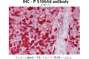 Image no. 1 for anti-S100 Calcium Binding Protein A9 (S100A9) (C-Term) antibody (ABIN1515088) (S100A9 anticorps  (C-Term))