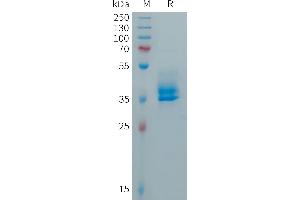 Human CALCA(85-141) Protein, hFc Tag on SDS-PAGE under reducing condition. (CGRP Protein (AA 85-141) (Fc Tag))