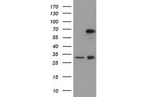 HEK293T cells were transfected with the pCMV6-ENTRY control (Left lane) or pCMV6-ENTRY MPP3 (Right lane) cDNA for 48 hrs and lysed. (MPP3 anticorps)