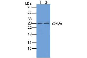Figure. (GSTM1 anticorps  (AA 1-218))