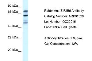 Western Blotting (WB) image for anti-Eukaryotic Translation Initiation Factor 2B, Subunit 5 Epsilon, 82kDa (EIF2B5) (N-Term) antibody (ABIN786396) (EIF2B5 anticorps  (N-Term))