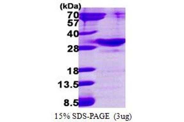 RAB34 Protein (AA 1-259) (His tag)