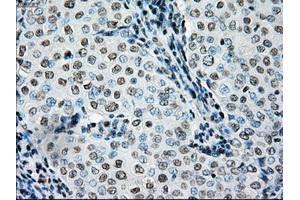 Image no. 2 for anti-B-Raf proto-oncogene, serine/threonine kinase (BRAF) antibody (ABIN1496959) (BRAF anticorps)