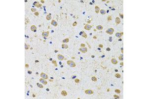 Immunohistochemistry of paraffin-embedded rat brain using EPHA2 Antibody (ABIN5975494) at dilution of 1/100 (40x lens). (EPH Receptor A2 anticorps)