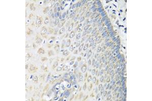 Immunohistochemistry of paraffin-embedded human esophagus using OXCT1 antibody (ABIN5974499) at dilution of 1/100 (40x lens). (OXCT1 anticorps)